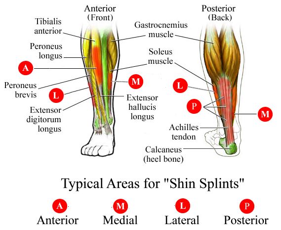 shin splint areas.jpg